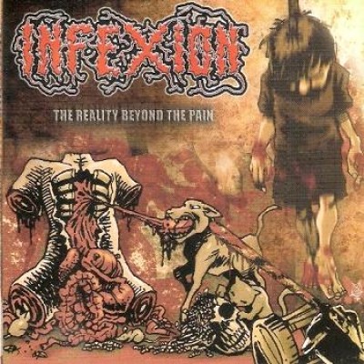 Infexion - The Reality Beyond the Pain