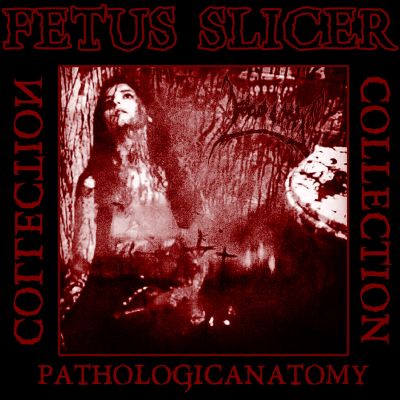 Fetus Slicer - Early Pathologicanatomy Collection