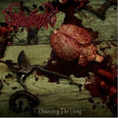 Anomalistic - Dissecting the Living