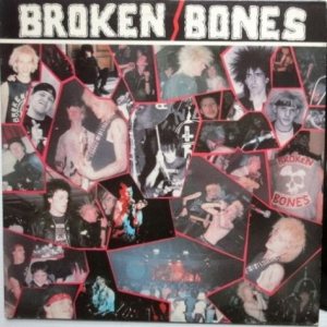 Broken Bones - Never Say Die