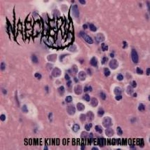 Naegleria - Some Kind of Brain Eating Amoeba