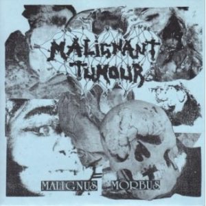 Malignant Tumour / Decomposed - Malignus Morbis / Labyrinth of Lights