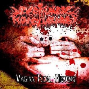 Perialnble Kondilombl - Vagina Real History