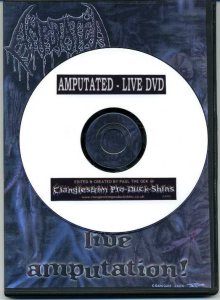 Amputated - Live Amputation!