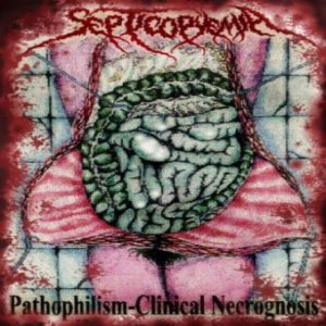 Septicopyemia - Pathophilism-Clinical Necrognosis