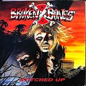 Broken Bones - Stitched Up