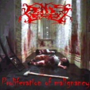 Penis Leech - Proliferation of Malignancy
