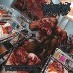 Embryectomy - Gluttonous Mastication of Embryonic Remnants cover art