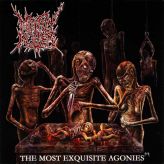 Mindly Rotten - The Most Exquisite Agonies cover art