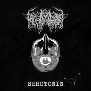 Anxiety Disorder - Serotonin