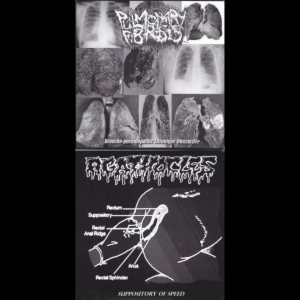 Pulmonary Fibrosis / Agathocles - Broncho-Pneumopathie Chronique Obstructive / Suppository of Speed