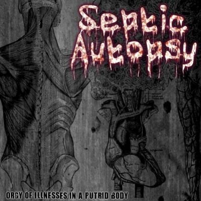 Septic Autopsy - Orgy of Illnesses in a Putrid Body