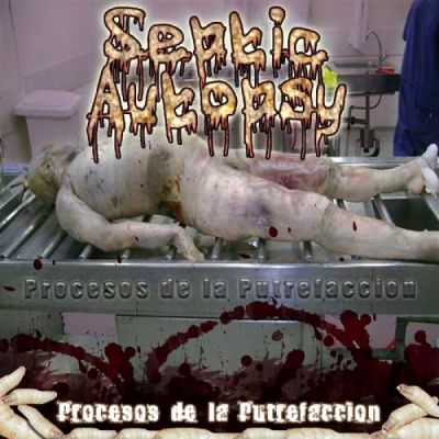Septic Autopsy - Procesos de la putrefaccion