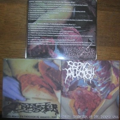 Septic Autopsy / Infester - Carnal Dissection of the Thoraco Wall / Hidden Medico-Pathological Inquests (Part 1)