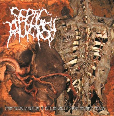 Septic Autopsy - Spontaneous Emanation of Rotting Smell Through Necropsy Process