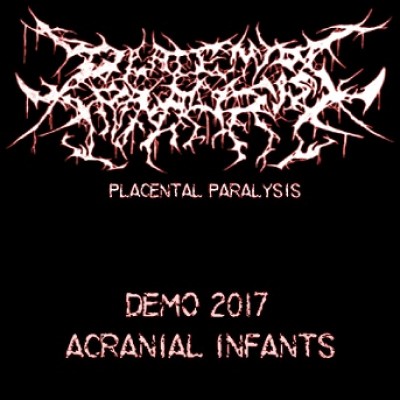Placental Paralysis - Demo 2017 Acranial Infants