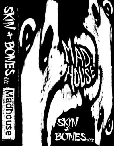 Skin & Bones - Madhouse