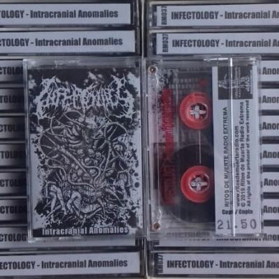 Infectology - Intracranial Anomalies