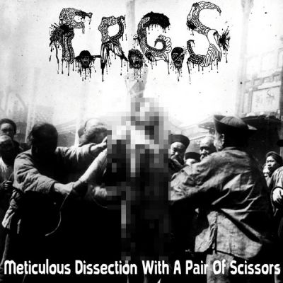 Festering Recto Gangrenous Slime - Meticulous Dissection with a Pair of Scissors