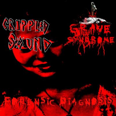 Grave Syndrome - Forensic Diagnosis
