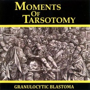 Granulocytic Blastoma - Moments of Tarsotomy