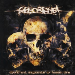Seborrhea - Different Segments of Human Life