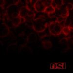 OSI - Blood cover art