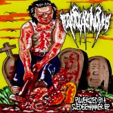 Teratocarcinomas - Pulverized by a Sledgehammer cover art