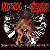 Incision - Cephalothoracopacus Premature Malformation cover art